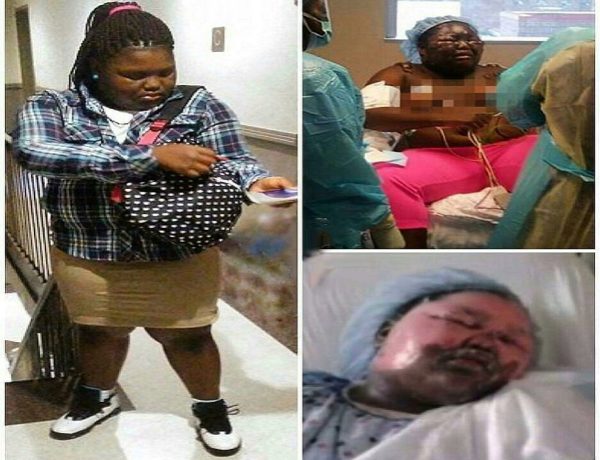 11 Year Old Girl Severely Burned in Gruesome "Hot Water Challenge" Prank